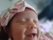 TikTok: Bebê nasce com dois dentes e viraliza nas 