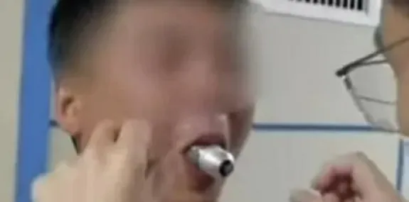 VÍDEO: Homem fica com lâmpada presa na boca após t