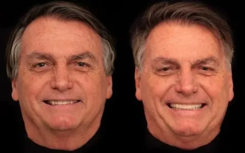 Agora com um novo sorriso, Bolsonaro irá depor pel