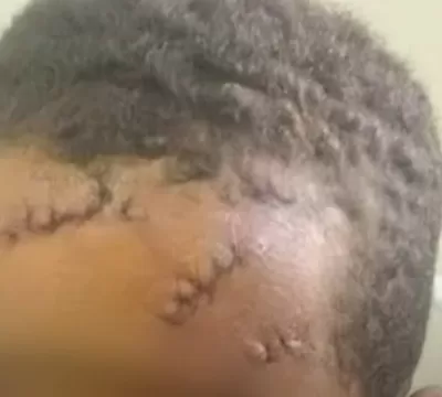 COVARDIA: Criança de 8 anos é brutalmente agredida