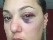Noiva de ex-lutador do MMA relembra espancamento a