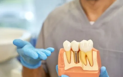 Brasil Sorridente - Implante dentário gratuito para pessoas de baixa renda