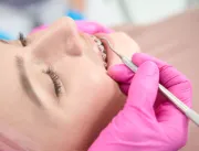Qual o tipo de resina utilizada na ortodontia?