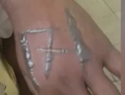 Funcionários acusam patrões de tatuarem ‘171’ no c