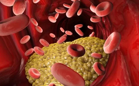 Dietbox explica mitos e verdades sobre o colestero