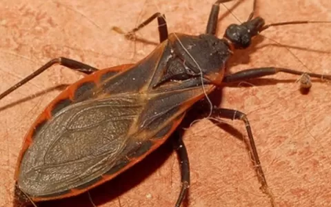 O que é a “Doença de Chagas”? Infectologista escla